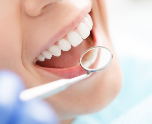 Endodoncias