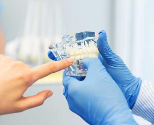 Prótesis dental