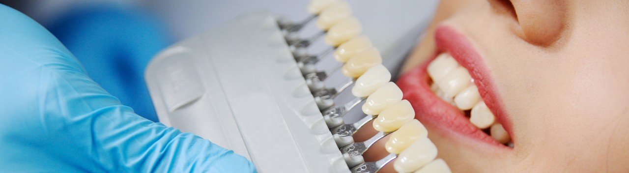 Estética dental :: Estilo13c