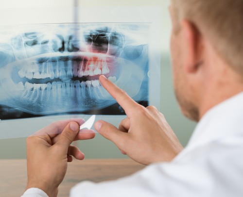 Estudio dental